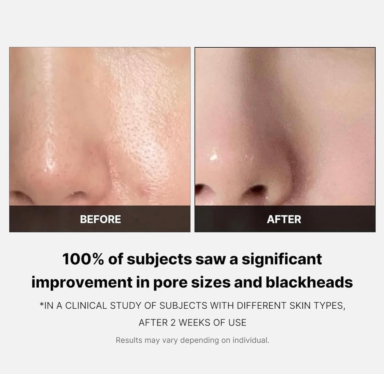 Medicube Zero Pore Pads – Exfoliating Toner Pads for Clear, Smooth, Pore‑Refined Skin 155G 70 pads (UK Stock)