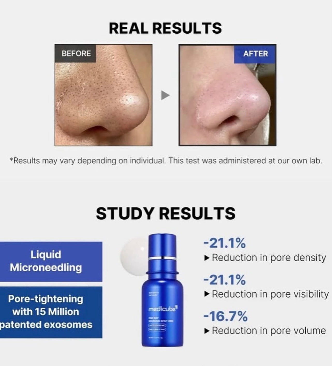 Medicube One Day Exosome Shot Pore Ampoule 2000 30ml – Intensive Pore‑Refining and Skin‑Smoothing Serum (UK Stock)