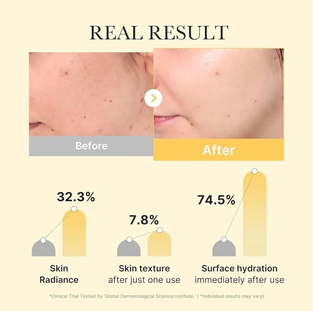 Medicube Kojic Acid Turmeric Brightening Gel Mask 28g (4pcs) – Dark Spot Correcting & Radiance‑Boosting Gel Sheet Mask (UK Stock)